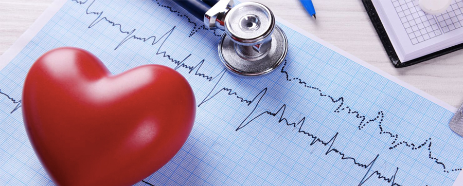 Arritmia Cardíaca: quando é necessário um CDI ou Marcapasso?