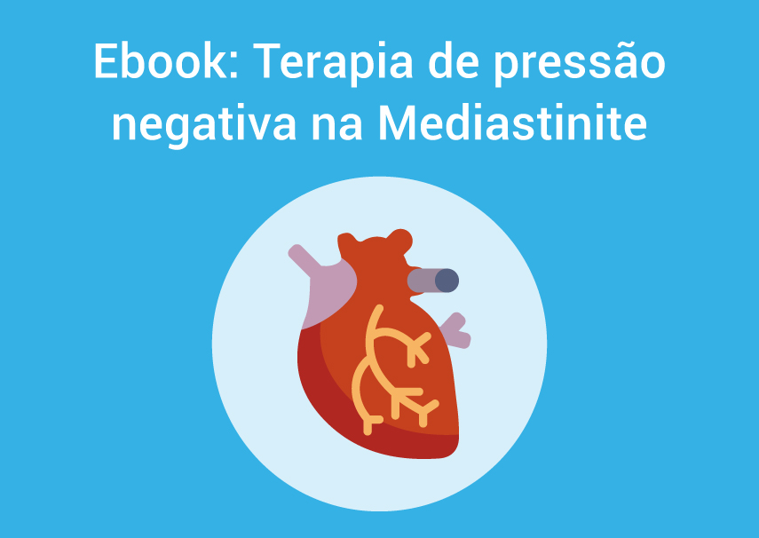 Passo a passo: terapia de pressão negativa na Mediastinite